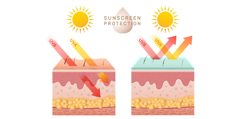 A vector showcasing the difference between the sun against the skin with vs without sunscreen